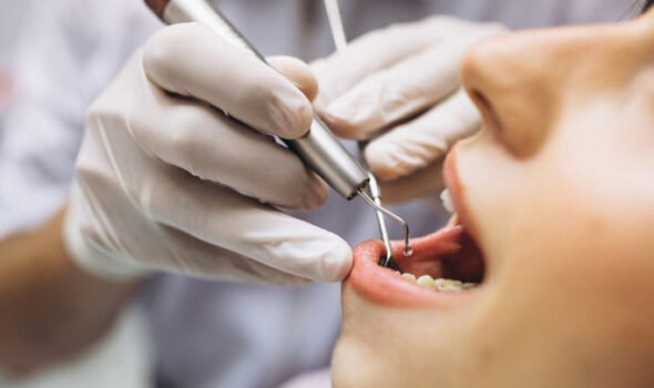 gömülü diş tedavisi nasıl yapılır