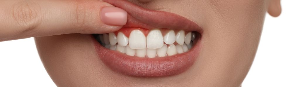 Diş Kökü İltihabı Tedavisi